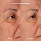 Bioadaptive Stress Repair